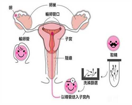 代孕期，补叶酸很重要，但这5种营养也要补，胎