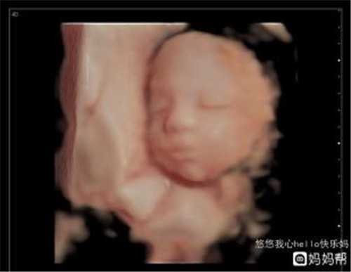 调查武汉代孕网监测排卵好几个月就是不代怀孕