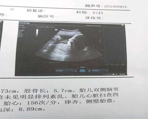 能做供卵试管婴儿的医院-广州借卵试管移植